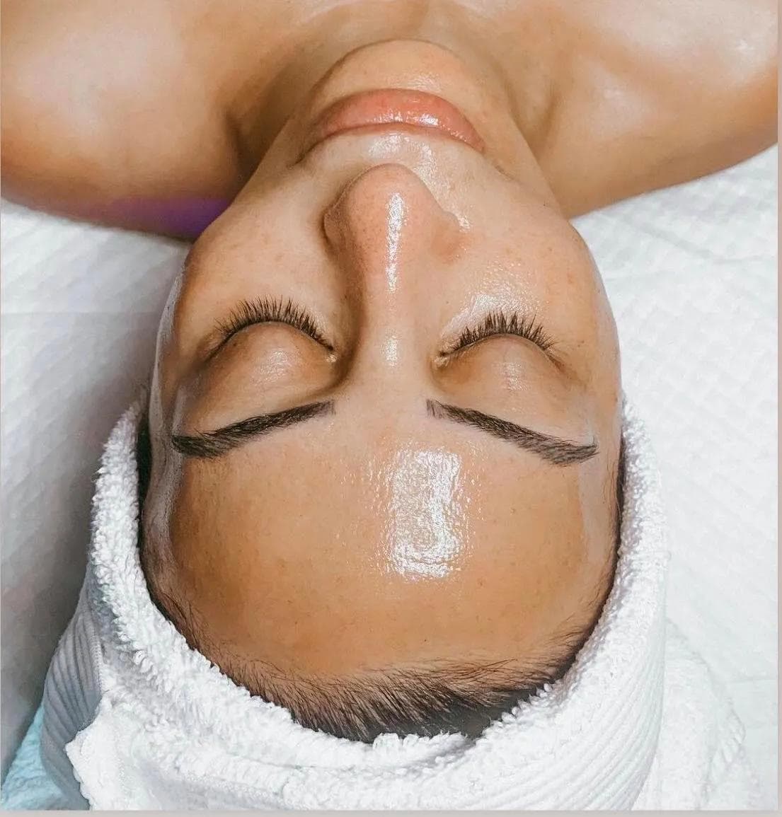 The Science of BioRePeel: Zero-Downtime Cellular Skin Renewal